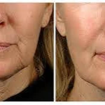 Lazer Logix. Beauty & Health in Port Elizabeth Eastern Cape