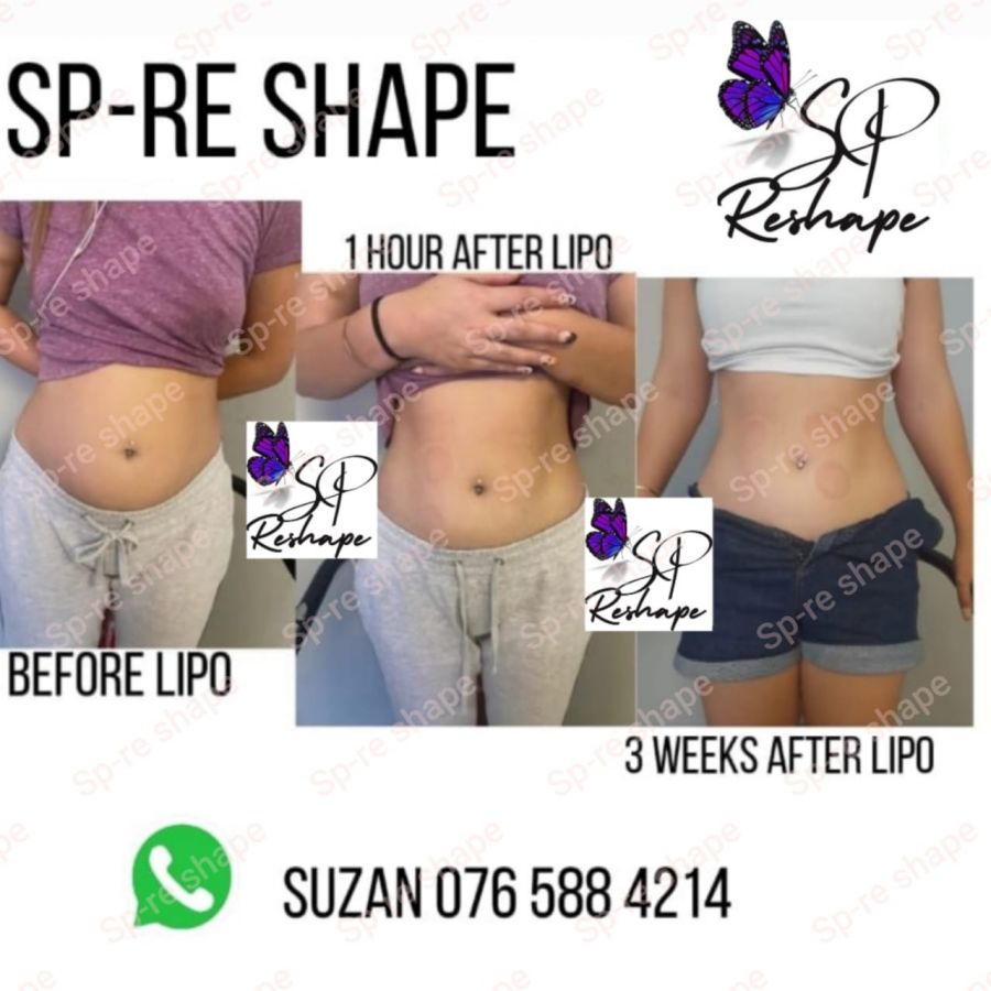 SP Reshape Beauty and Health in Randburg Johannesburg Gauteng