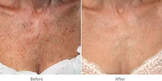 Lazer Logix. Beauty & Health in Port Elizabeth Eastern Cape